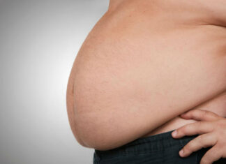 Study Links Alcoholism To Obesity Obesity in the NHS