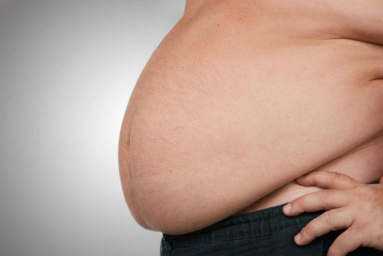 Local Doctors Do Not Take Obesity Serious Says In2town Magazine Local Doctors Do Not Take Obesity Serious Says In2town Magazine