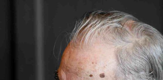 Are You Missing Out on These Pension Top-Ups? The Most Underclaimed Benefits in the UK People Could Be Forced To Work Until They Are 70